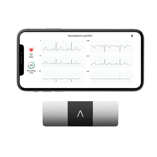 AliveCor KardiaMobile 6L | Le Moniteur ECG Personnel connecté à 6 dérivations. Détectez la Fibrillation auriculaire en Seulement 30 Secondes - à Tout Moment, n'importe où.