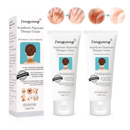 Fengyang® 2Pcs Crème Acanthosis Nigricans, Crème Anti-taches Foncées, Crème Correctrice Taches Noires, Élimination de l'hyperpigmentation pour l'articulation du coude, du genou