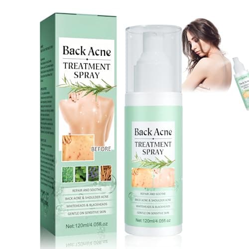Acné Dos, Traitement de l'acné Corporelle, Spray de Traitement de l'acné pour le Dos, Spray Nettoyant pour l'acné du dos, Nettoyage en Profondeur de l'acné du Corps, Votre Peau Plus Lisse, 120ml